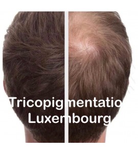 Tricopigmentation